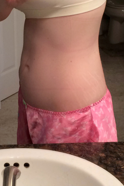 belly-bandit-review-03-2-weeks-5-days